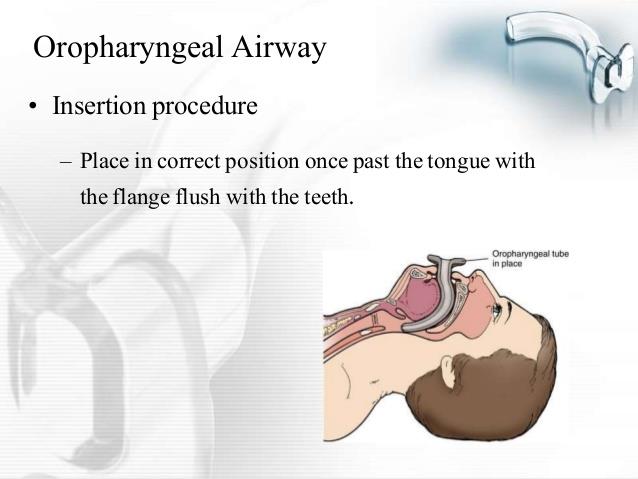 oral-airway-presentation-11-638